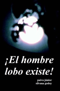 ¡El hombre lobo existe!