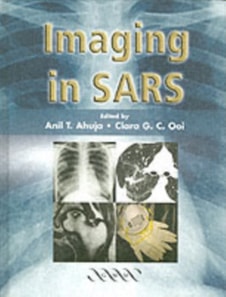 Imaging in SARS