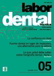 Labor Dental Técnica Nº5 Vol.25
