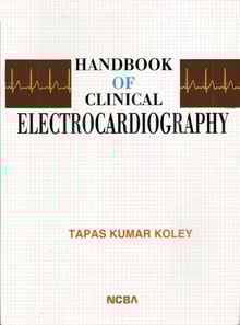 Handbook of Clinical Electrocardiography