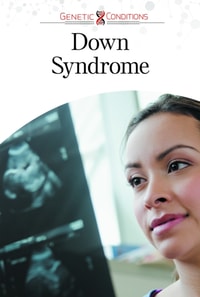 Down Syndrome