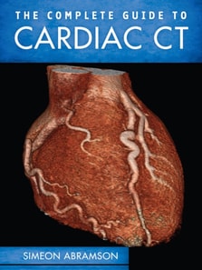 Complete Guide To Cardiac CT (PB)
