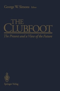 Clubfoot
