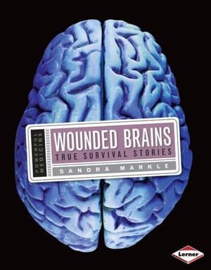 Wounded Brains