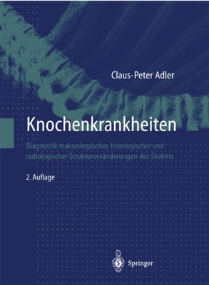 Knochenkrankheiten