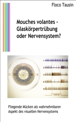 Mouches volantes: Glaskorpertrubung oder Nervensystem?