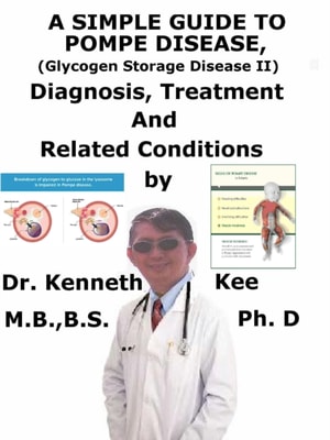 Simple Guide to Pompe Disease (Glycogen Storage Disease II), Diagnosis, Treatment and Related Conditions