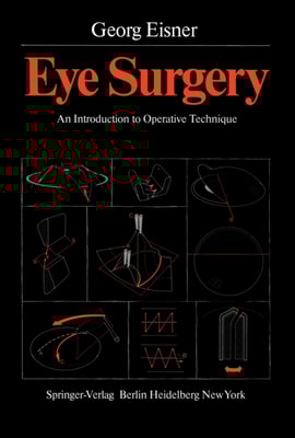 Eye Surgery