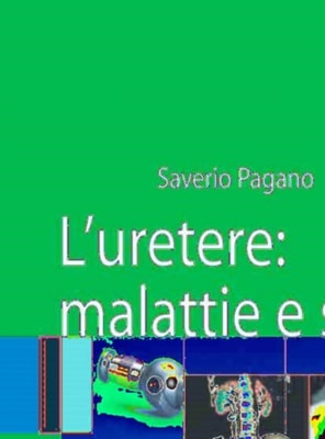 L'uretere: malattie e sintomi