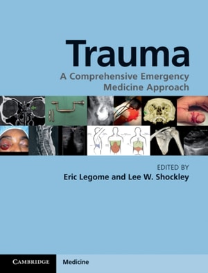 Trauma