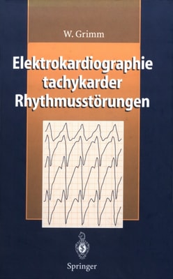 Elektrokardiographie tachykarder Rhythmusstörungen
