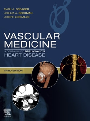 Spine Secrets E-Book
