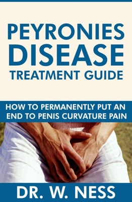 Peyronies Disease Treatment Guide: How to Permanently Put an End to Penis Curvature Pain.