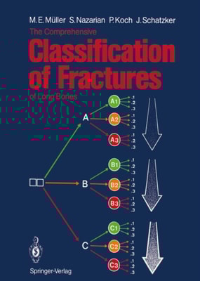 Comprehensive Classification of Fractures of Long Bones