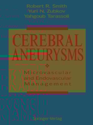 Cerebral Aneurysms