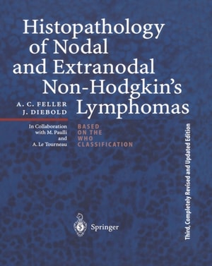 Histopathology of Nodal and Extranodal Non-Hodgkin's Lymphomas
