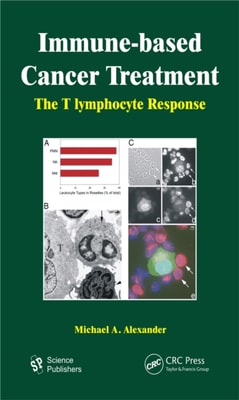 Immune-based Cancer Treatment