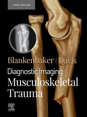Operative Techniques: Hand and Wrist Surgery E-Book
