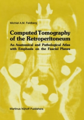 Computed Tomography of the Retroperitoneum