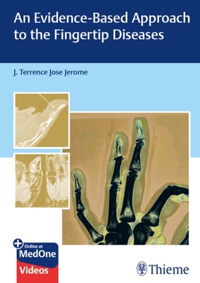 Evidence-Based Approach to the Fingertip Diseases