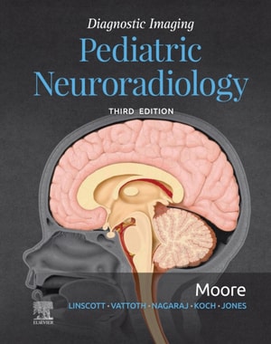 Case Studies in Neuromuscular Disorders, An Issue of Neurologic Clinics