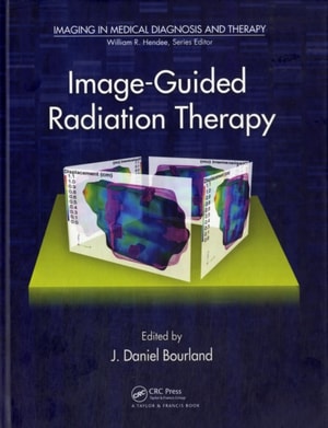 Image-Guided Radiation Therapy