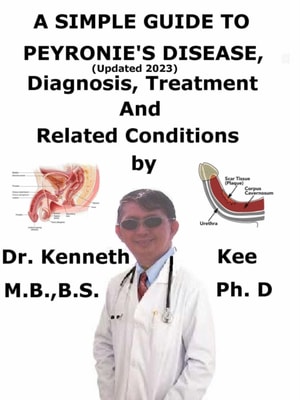 Simple Guide to Peyronie's Disease, (Updated 2023) Diagnosis, Treatment and Related Conditions