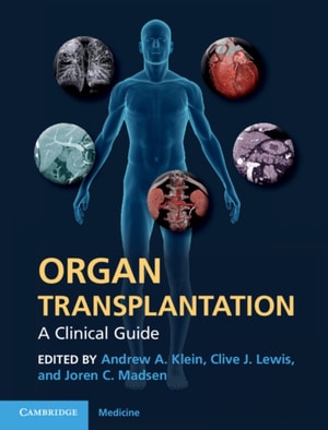 Organ Transplantation