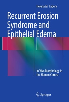 Recurrent Erosion Syndrome and Epithelial Edema