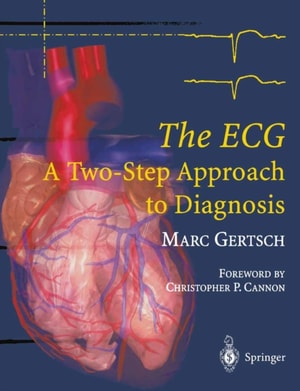 ECG