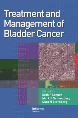 Treatment and Management of Bladder Cancer