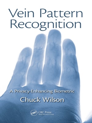 Vein Pattern Recognition
