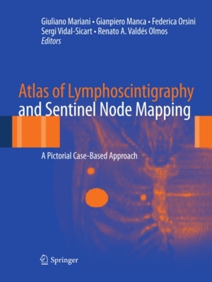 Atlas of Lymphoscintigraphy and Sentinel Node Mapping