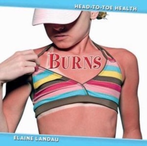 Burns