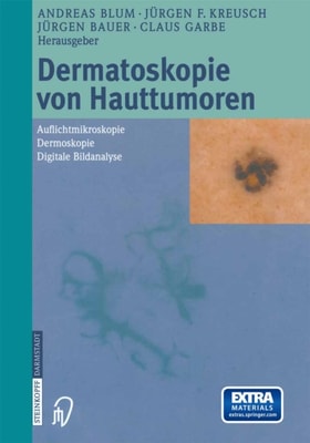 Dermatoskopie von Hauttumoren