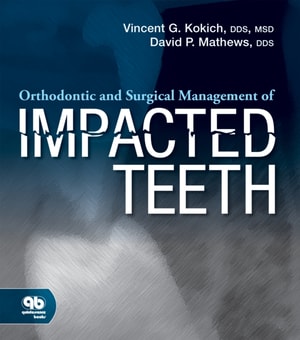 20 Years of Guided Bone Regeneration in Implant Dentistry