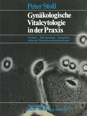 Gynäkologische Vitalcytologie in der Praxis