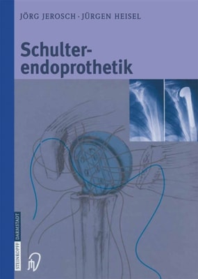 Schulterendoprothetik