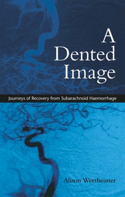 Dented Image