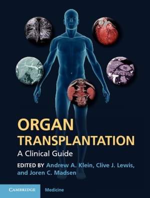 Organ Transplantation