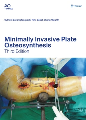 Minimally Invasive Plate Osteosynthesis