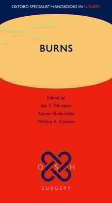 Burns