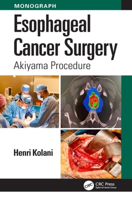 Esophageal Cancer Surgery