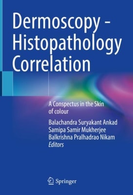 Dermoscopy - Histopathology Correlation 