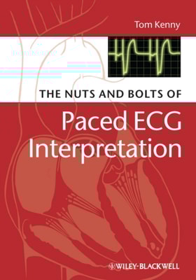 Pharmacological Treatment of Acute Coronary Syndromes
