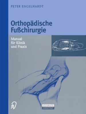 Orthopädische Fußchirurgie