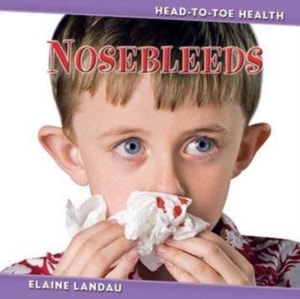 Nosebleeds