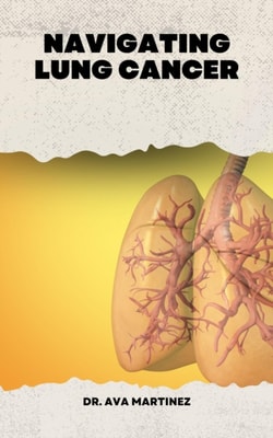 Navigating Lung Cancer