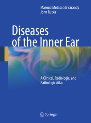 Diseases of the Inner Ear