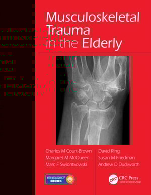 Musculoskeletal Trauma in the Elderly